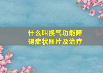 什么叫换气功能障碍症状图片及治疗