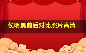 侯明昊前后对比照片高清