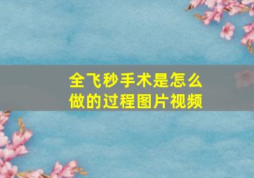 全飞秒手术是怎么做的过程图片视频