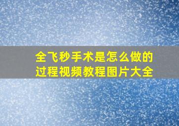 全飞秒手术是怎么做的过程视频教程图片大全