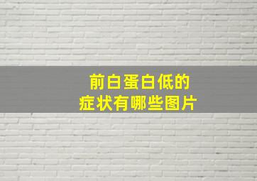 前白蛋白低的症状有哪些图片