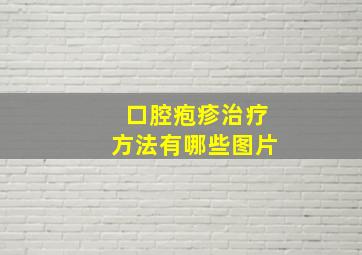 口腔疱疹治疗方法有哪些图片