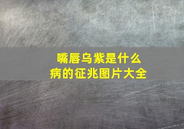 嘴唇乌紫是什么病的征兆图片大全