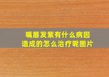 嘴唇发紫有什么病因造成的怎么治疗呢图片