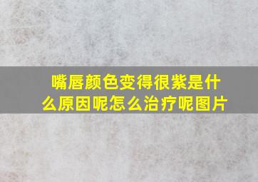 嘴唇颜色变得很紫是什么原因呢怎么治疗呢图片