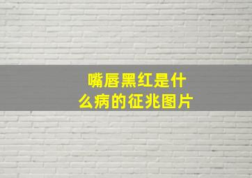 嘴唇黑红是什么病的征兆图片