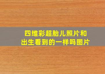 四维彩超胎儿照片和出生看到的一样吗图片