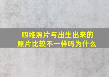 四维照片与出生出来的照片比较不一样吗为什么