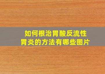 如何根治胃酸反流性胃炎的方法有哪些图片