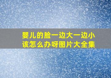 婴儿的脸一边大一边小该怎么办呀图片大全集