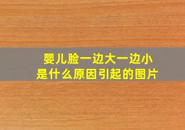 婴儿脸一边大一边小是什么原因引起的图片