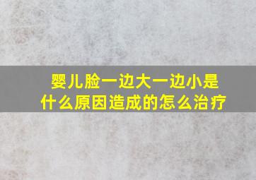 婴儿脸一边大一边小是什么原因造成的怎么治疗