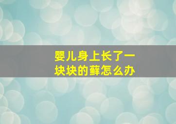 婴儿身上长了一块块的藓怎么办