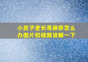 小孩子老长荨麻疹怎么办图片和视频讲解一下