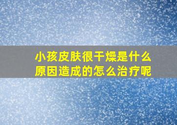 小孩皮肤很干燥是什么原因造成的怎么治疗呢