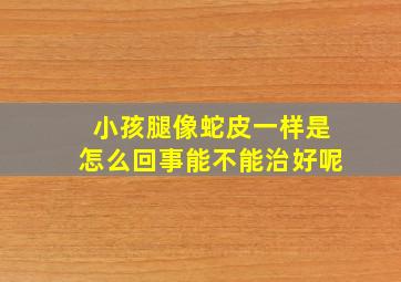 小孩腿像蛇皮一样是怎么回事能不能治好呢