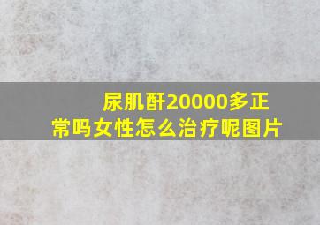 尿肌酐20000多正常吗女性怎么治疗呢图片