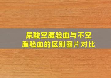 尿酸空腹验血与不空腹验血的区别图片对比