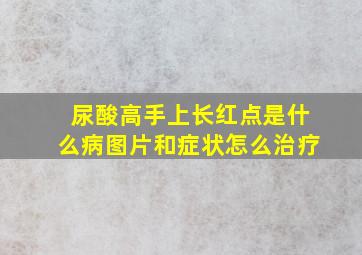 尿酸高手上长红点是什么病图片和症状怎么治疗