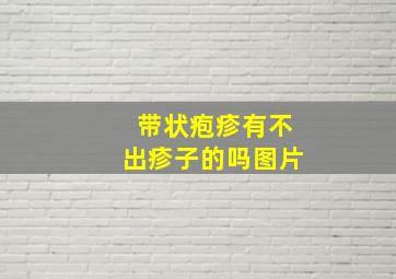 带状疱疹有不出疹子的吗图片