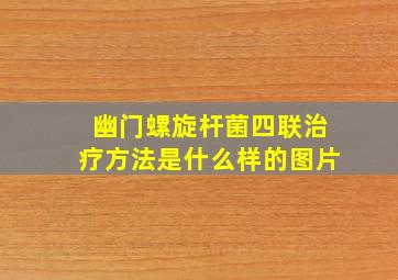 幽门螺旋杆菌四联治疗方法是什么样的图片