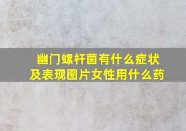 幽门螺杆菌有什么症状及表现图片女性用什么药