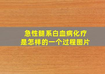 急性髓系白血病化疗是怎样的一个过程图片