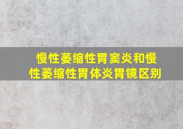 慢性萎缩性胃窦炎和慢性萎缩性胃体炎胃镜区别