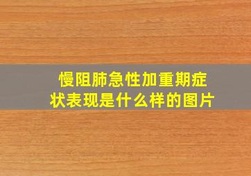 慢阻肺急性加重期症状表现是什么样的图片