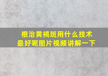 根治黄褐斑用什么技术最好呢图片视频讲解一下