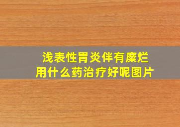 浅表性胃炎伴有糜烂用什么药治疗好呢图片