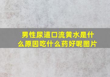 男性尿道口流黄水是什么原因吃什么药好呢图片