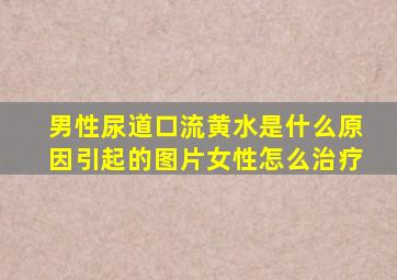 男性尿道口流黄水是什么原因引起的图片女性怎么治疗