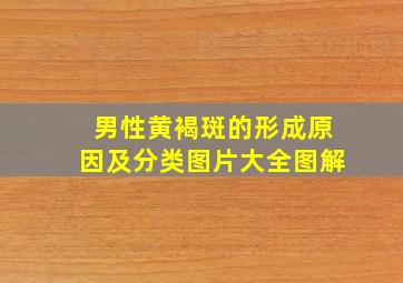 男性黄褐斑的形成原因及分类图片大全图解