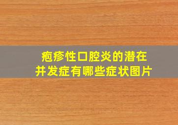 疱疹性口腔炎的潜在并发症有哪些症状图片