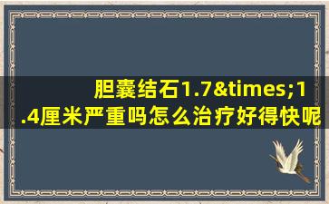 胆囊结石1.7×1.4厘米严重吗怎么治疗好得快呢