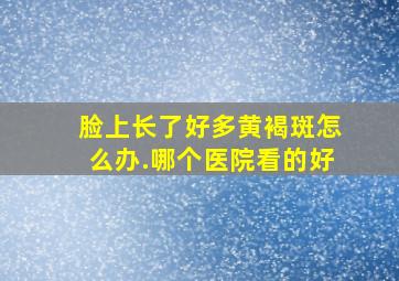 脸上长了好多黄褐斑怎么办.哪个医院看的好