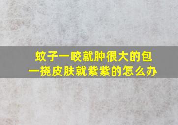 蚊子一咬就肿很大的包一挠皮肤就紫紫的怎么办