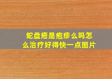 蛇盘疮是疱疹么吗怎么治疗好得快一点图片