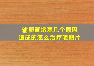 输卵管堵塞几个原因造成的怎么治疗呢图片