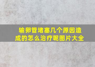 输卵管堵塞几个原因造成的怎么治疗呢图片大全