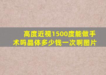 高度近视1500度能做手术吗晶体多少钱一次啊图片