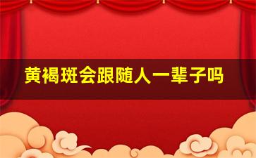 黄褐斑会跟随人一辈子吗