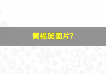 黄褐斑图片?