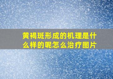 黄褐斑形成的机理是什么样的呢怎么治疗图片