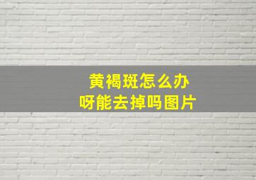 黄褐斑怎么办呀能去掉吗图片