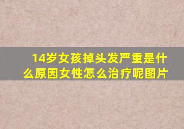 14岁女孩掉头发严重是什么原因女性怎么治疗呢图片