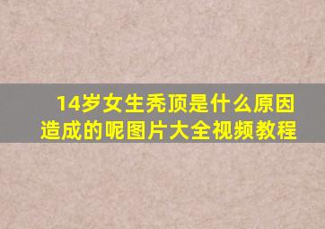 14岁女生秃顶是什么原因造成的呢图片大全视频教程